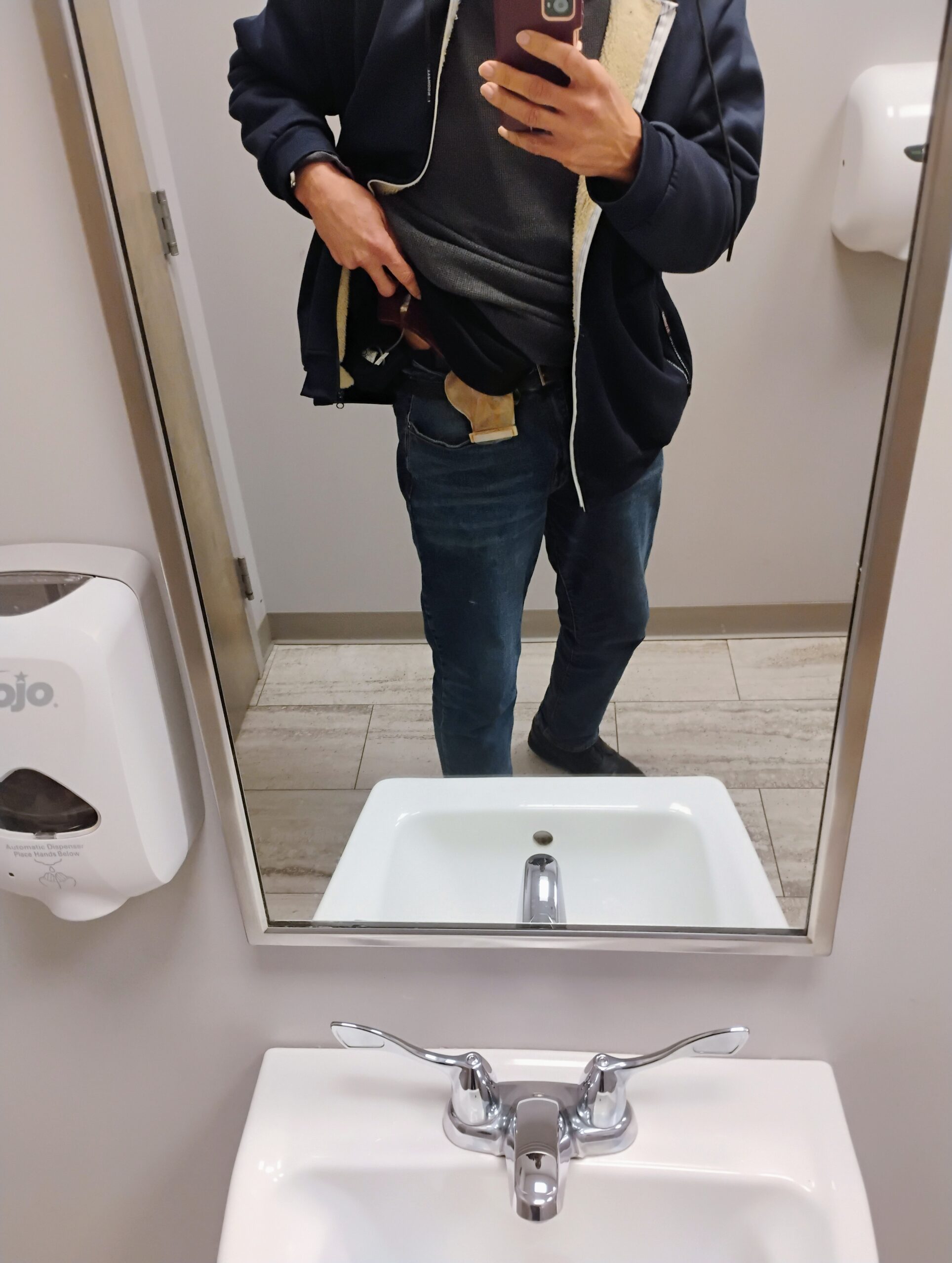 LIVING WITH A PROLAPSED STOMA — ARTICLE 1